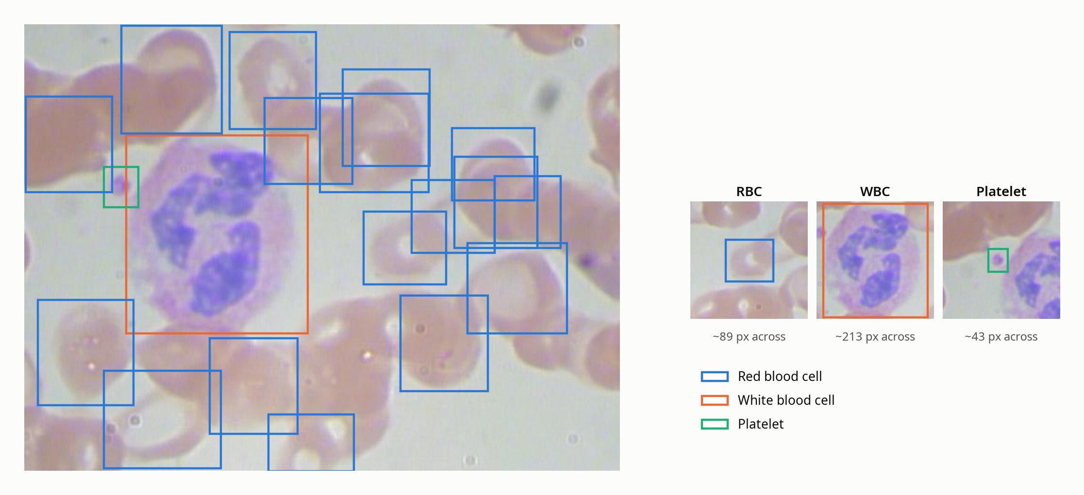 A test photo with every labeled cell boxed: about fifteen red cells in blue, one large white cell in orange, and one small platelet in green; three crops beside it show a red cell about 89 pixels across, a white cell about 213, and a platelet about 43, all at the same scale. Several red cells at the right edge have no box.