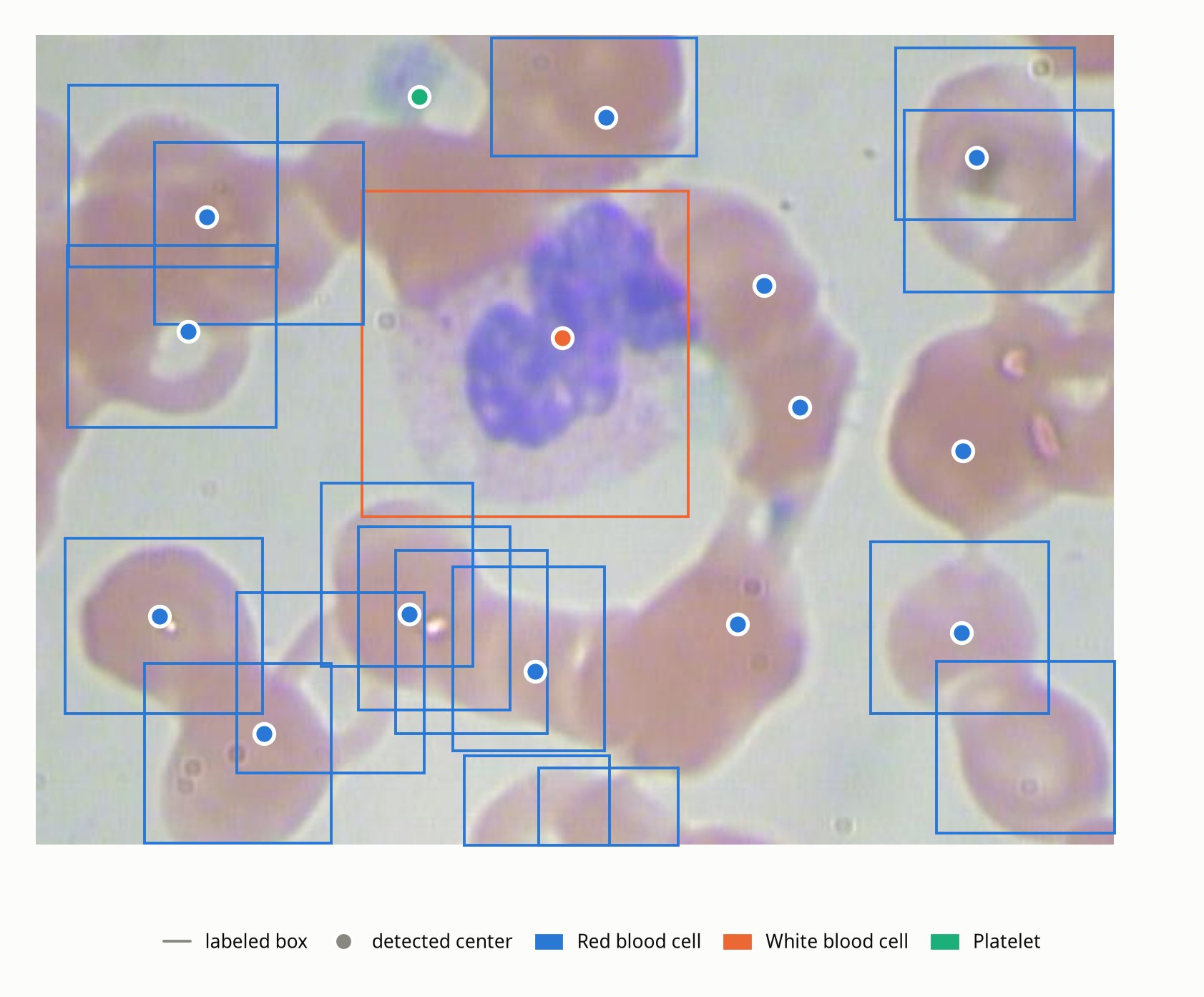 Test photo BloodImage_00007 with its labeled boxes and one model's detections as dots: one white-cell detection at the center of the large white cell, one platelet at top left, and thirteen red-cell detections, four of them on red cells at the right that have no labeled box.